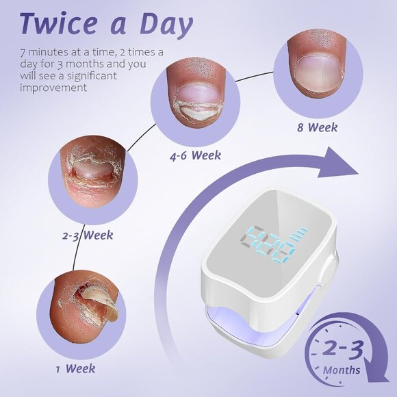 Nail Fungus Laser Treatment LED Light Device-Fungal Nail Treatment, - Picture 6 of 8